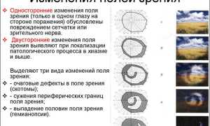Выпадение поля зрения и сужение – причины, как проверяют и что делать