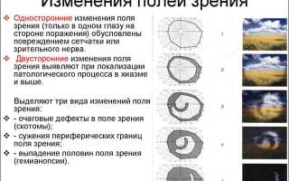 Выпадение поля зрения и сужение – причины, как проверяют и что делать