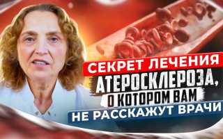 Лечение атеросклероза — 13 способов: народная медицина, советы врачей, видео