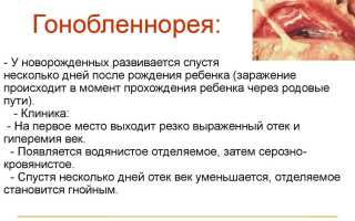 Глаза красные и гноятся – что делать, если чешутся и краснеют, советы врачей