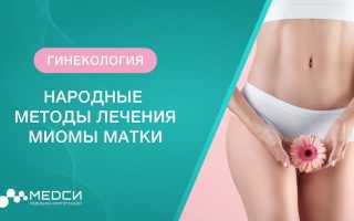 Фиброма матки: медицина и народные средства, эффективные рецепты, видео