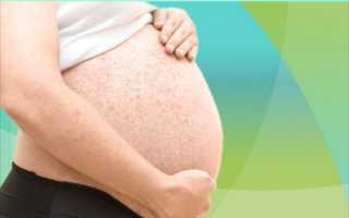 Лечение отрубевидного лишая во время беременности — безопасные методы и рекомендации для будущих мам