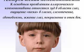 Обзор эффективных капель для глаз от аллергии: полезные советы и рекомендации