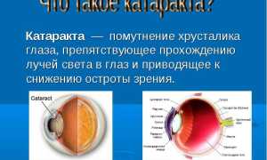 Операция по замене хрусталика глаза: виды и этапы проведения для пациентов