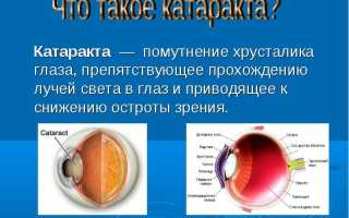 Операция по замене хрусталика глаза: виды и этапы проведения для пациентов