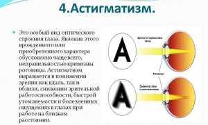 Метод Бейтса по восстановлению зрения – упражнения согласно методике для улучшения зрения