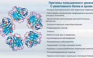 Зачем нужен анализ на С реактивный белок при беременности и его значение