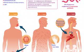 Сифилис при беременности — причины болезни, пути заражения, влияние на малыша и методы профилактики