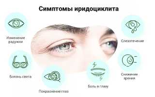 Иридоциклит: описание болезни, причины, методы лечения и диагностики, а также рекомендации