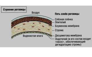 Кератит глаза – воспаление роговицы и его симптомы