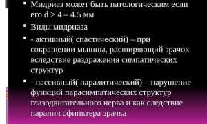 Почему зрачки расширены – причины широких и увеличенных у взрослого человека и их последствия