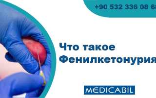 Можно ли рожать, если поставлен диагноз фенилкетонурия при беременности, и что нужно знать?