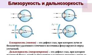 Линзы пролонгированного ношения: особенности пользования и ухода для здоровья глаз