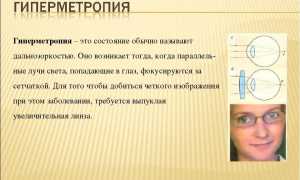 Код по МКБ – гиперметропия: дальнозоркость, пресбиопия слабой степени и их особенности