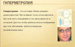 Код по МКБ – гиперметропия: дальнозоркость, пресбиопия слабой степени и их особенности