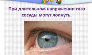 Почему лопается сосуд в глазу – причины и что делать для здоровья