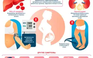 Эклампсия у беременных — как распознать и помочь в критической ситуации