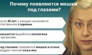 Мешки под глазами – удаление и операция: как убрать хирургически эффективно