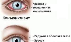 Капли в глаза от инфекции – глазные от конъюнктивита с антибиотиком для лечения