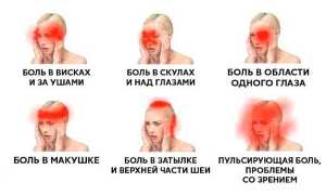 Головная боль в области глаз и лба: болит голова и что с этим делать