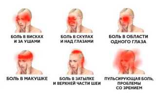 Головная боль в области глаз и лба: болит голова и что с этим делать