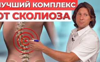 Как вылечить сколиоз в домашних условиях? Способы лечения, видео