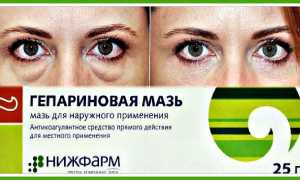 Гепариновая мазь как средство от отеков и мешков под глазами: полезные советы
