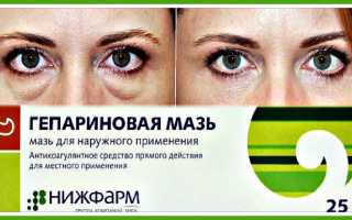 Гепариновая мазь как средство от отеков и мешков под глазами: полезные советы