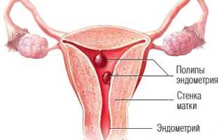 Спазм шейки матки во время родов — что это, как предупредить и справиться