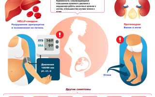 Что такое преэклампсия беременных, какое лечение необходимо для здоровья