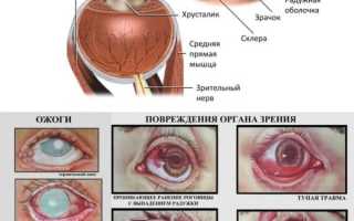 Чем закапать глаза после сварки – глазные обезболивающие для быстрого восстановления