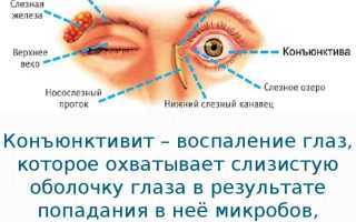 Симптомы и методы лечения конъюнктивита у взрослых и детей