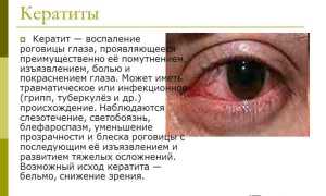 Симптомы и методы лечения кератита у взрослых