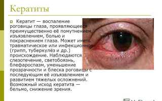 Симптомы и методы лечения кератита у взрослых