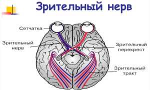 Частичная атрофия зрительного нерва: лечение и профилактика