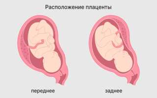 Размеры плаценты: особенности формирования, строения, функций и изменений в процессе беременности для будущих мам