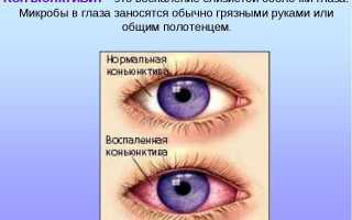 Какие бывают глазные капли для новорожденных: полезная информация