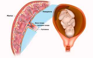 Инфаркт плаценты: причины и последствия