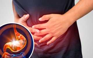 Гастрит при беременности: причины и лечение