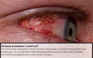 Глаз покраснел и слезится – что делать в домашних условиях для быстрого облегчения