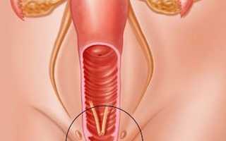 Деформация шейки матки при беременности: что это, почему возникает, чем опасно и как с этим справиться