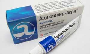 Основные свойства и методы применения глазной мази Ацикловир в офтальмологии
