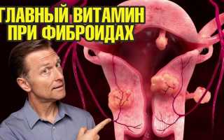 Миома матки: что это такое и как ее лечить? Медицина и народные средства, видео