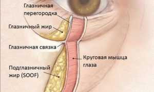 Грыжа нижнего века: причины и лечение патологии у пациентов