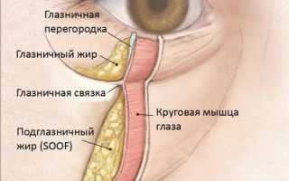 Грыжа нижнего века: причины и лечение патологии у пациентов