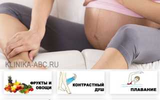 Роды при варикозе в паху: причины, лечение, особенности родов и рекомендации