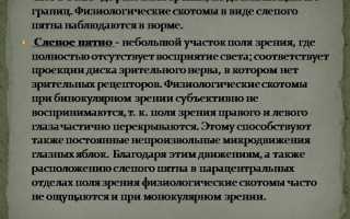Стокомы зрительного аппарата: причины возникновения и лечение, советы специалистов