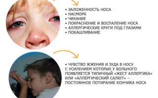 Аллергический насморк: симптомы у детей, причины, лечение дома