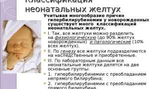 Желтоватые белки глаз у новорожденных и желтое лицо: причины и лечение