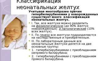 Желтоватые белки глаз у новорожденных и желтое лицо: причины и лечение